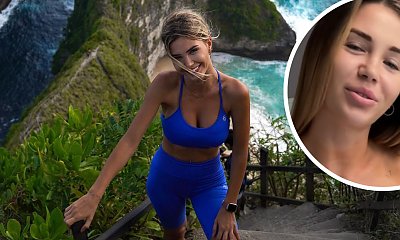 Angela z "Love Island" zmniejszyła sobie biust. Reakcje ludzi do przewidzenia