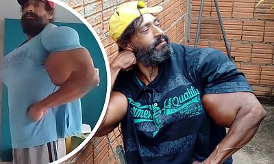 Brazylijczyk chciał upodobnić się do Hulka. Zmarł w dniu swoich 55. urodzin. Jego organizm nie wytrzymał