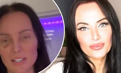 Fani martwią się o najlepszą, polską dziennikarkę. Monika Laskowska nie wstydzi się niedoskonałości