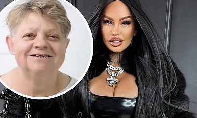 Mama Laluny ma nowe zęby z Turcji. Ludzie nie wierzą: "Ale laska"