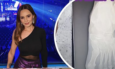 Ewelina Lisowska miała makabryczny wypadek. Zmiażdżyła stopę motocyklem! To zdjęcie rentgenowskie szokuje