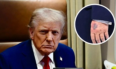 Zaprosił Putina, a potem stało się to. Biały Dom tłumaczy się z nowych siniaków Trumpa