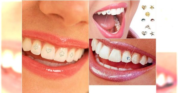 Znalezione obrazy dla zapytania zdobienie zębów