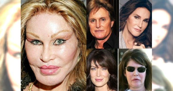 Największe i zarazem najdroższe operacje plastyczne gwiazd Hollywood. Czy wyszło im na dobre?