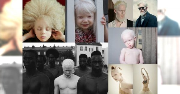 Te osoby z albinizmem są po prostu niewyobrażalnie piękne! Prawie 30 wyjątkowych fotografii, które musisz zobaczyć!
