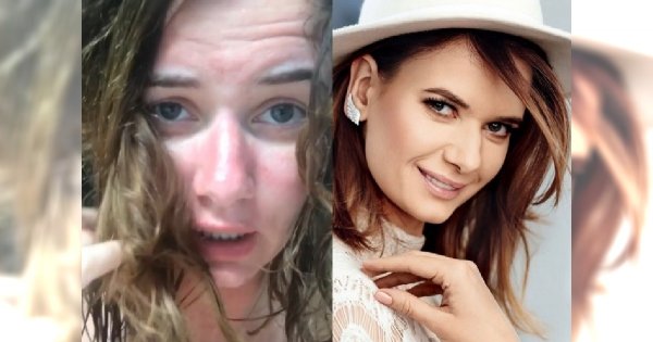 Malinowska pokazała zdjęcia z wakacji. Fani: "Cudownie naturalna!", inni: "Boże, jaka brzydka"