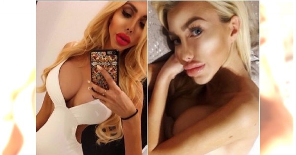 Polska Barbie Anella - coraz chudsze ciało i coraz większe usta. Jednak najbardziej przeraża talia!