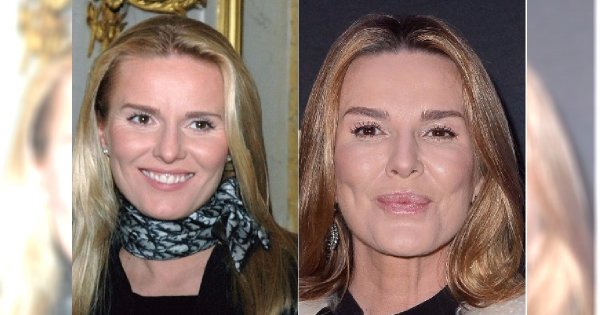 Hanna Lis zawsze zapewniała, że ma naturalne policzki. Nadal wierzycie?