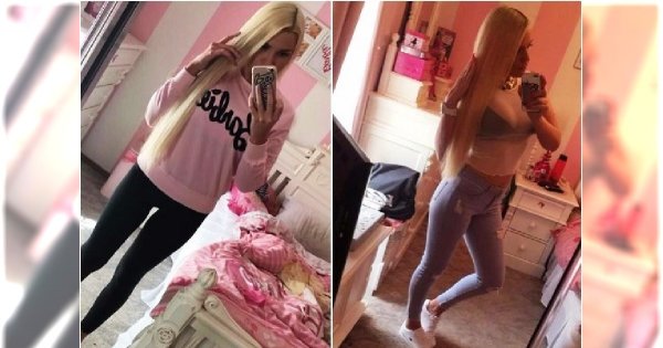 Brazylijski lifting zamiast ćwiczeń pośladków. Zobaczcie, jak teraz wygląda jej pupa!