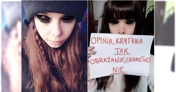 Fanka Popka walczy o wzrok w drugim oku. Czy całkowicie oślepnie? Jest OPINIA LEKARZY