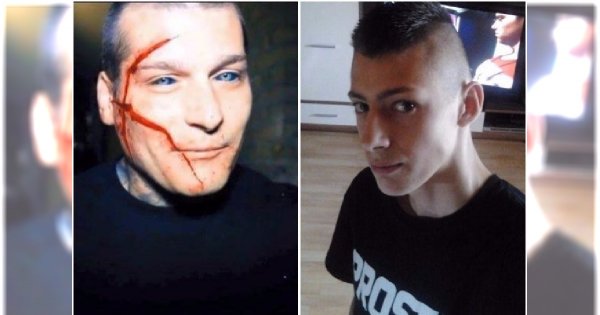 Ola Sadowska to nie jedyna ofiara mody na Popka. Pamiętacie tego chłopaka z pociętą twarzą?