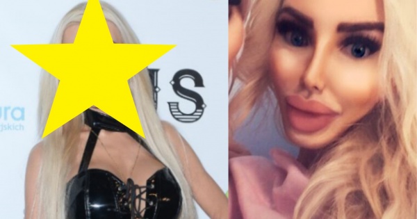 Anella na Instagramie vs. na ściance. Różnica jest OGROMNA! Czemu to sobie robi?