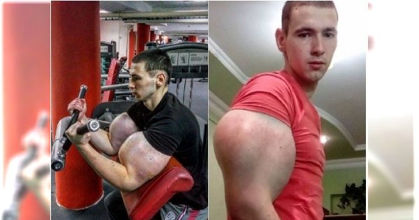 Pamiętacie słynnego "POPEYE'A", który przeholował z syntholem? Nie uwierzycie, jak dziś wygląda!