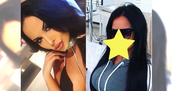 Esmeralda Godlewska powiększyła usta JESZCZE BARDZIEJ! Myśleliście, że nie może być już gorzej?
