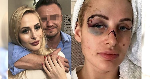 Katarzyna Dziedzic ujawnia SZOKUJĄCE SMS-y, które Miłosz P. pisał do klientek. "Lubisz w usta?"