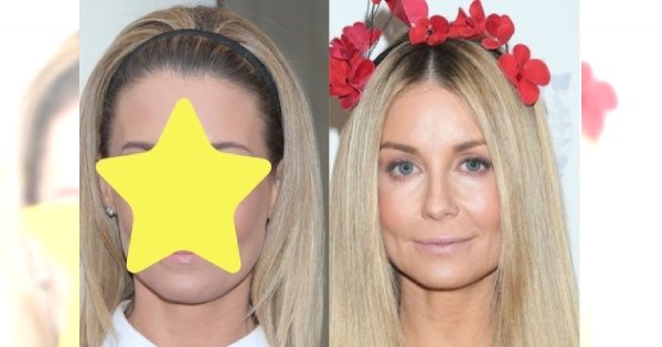 Projekt Lady miał premierę zaledwie 2 lata temu, a Rozenek zmieniła się DIAMETRALNIE. Pamiętacie, jak wtedy wyglądała?