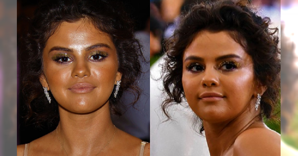 Met Gala 2018: Samoopalacz, czy zły makijaż? Co się stało z Seleną Gomez?