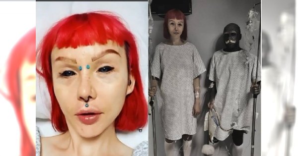 Veronica Blades, koleżanka Adama Curlykale, USUNĘŁA ŻEBRA i przerobiła uszy na elfie! Pokazała efekt