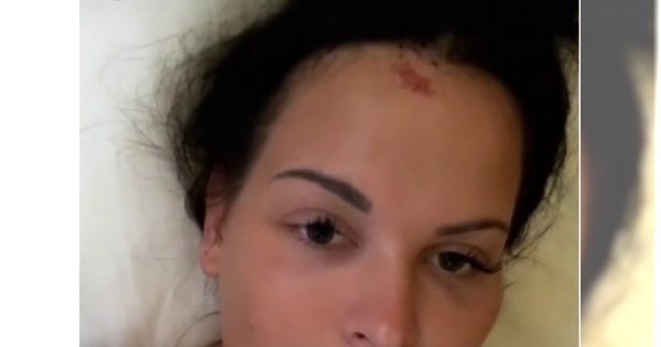 Monika Esmeralda pokazała się po wypadku. "Sorry za mój wygląd, ale jestem bez makijażu"