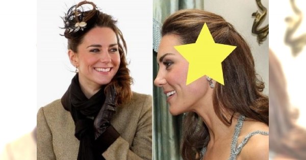 Księżna Kate Middleton ma na głowie DUŻĄ BLIZNĘ! "Bardzo POWAŻNA operacja"!