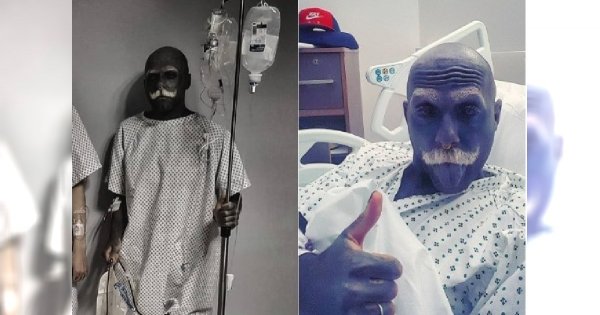 Adam Curlykale ma KOMPLIKACJE po usunięciu penisa i jąder. Prosi fanów o pieniądze! "Nie jestem w stanie spać z powodu silnego bólu"