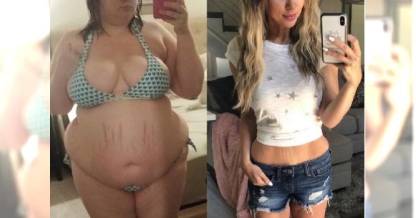Zrzuciła 70 KILOGRAMÓW i uwierzyła w siebie! W otyłość wpędzał ją ZAZDROSNY CHŁOPAK!