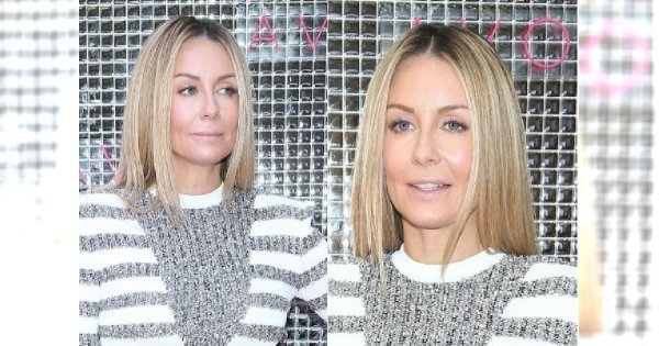 Małgosia Rozenek promuje Avon. Ale my patrzymy na jej nogi. Schudła już za bardzo?