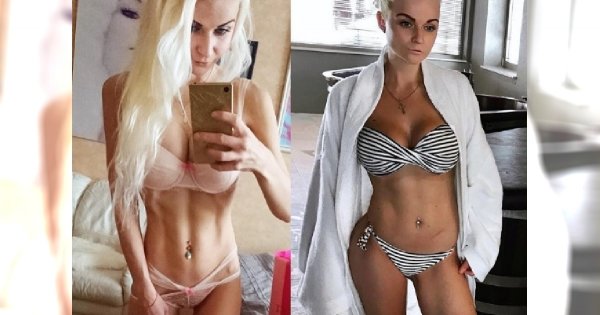 Poznajcie "Barbie z MÓZGIEM"! Z powodu anoreksji ta kobieta ważyła kiedyś tylko 34 KILO! Zdjęcia z tego okresu są PRZERAŻAJĄCE!