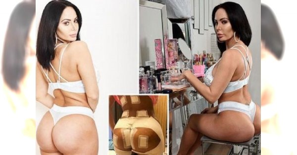 Celebrytka boi się, że implanty w jej pośladkach WYBUCHNĄ! Jej pupa wygląda "jak po wypadku". Nie decyduje się na kolejną operację z obawy o życie