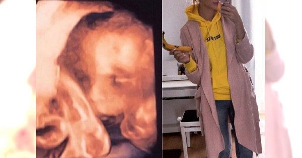 A to NIESPODZIANKA! Gwiazda "TOP MODEL" w ciąży! Pokazała zdjęcie USG