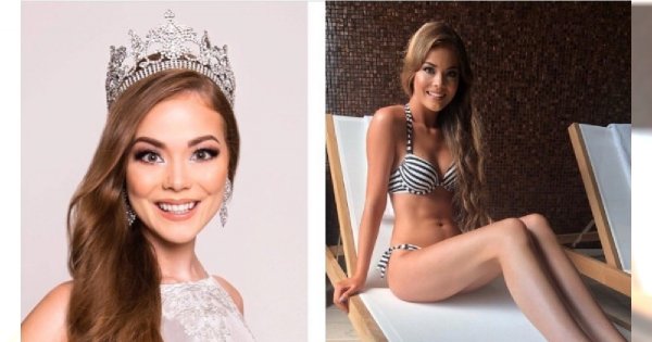 Miss Supranational 2018: Miss Danii urodziła się bez lewej ręki. "Możesz być piękna, nawet jeśli masz tylko jedną rękę"