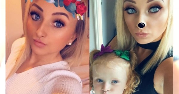 Wypełniacze ust tak bardzo zniekształciły jej twarz, że bała się jej własna córka! "Wyglądałam jak człowiek-słoń", opowiada