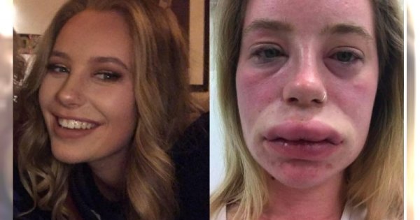 Gdy ta śliczna sanitariuszka podwijała rękawy, pacjenci odwracali się od niej ze WSTRĘTEM! "Proszę mnie nie dotykać!", mówili