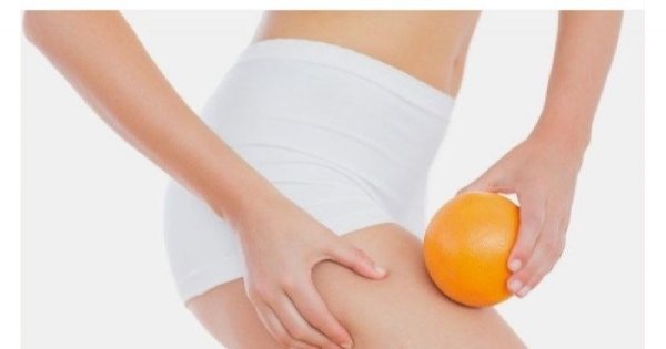 Endermologia - skuteczne modelowanie sylwetki. Na czym polega endermologia i jakie przynosi efekty?