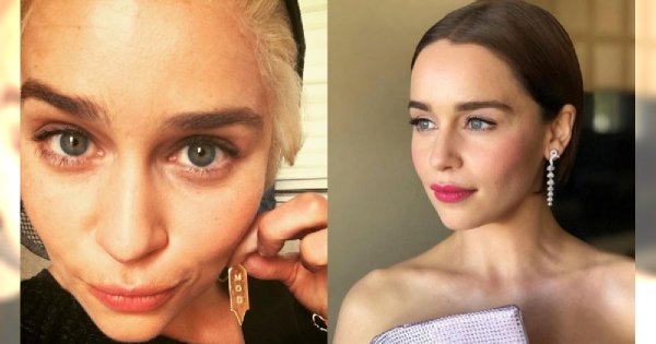 Emilia Clarke otarła się o śmierć! "W najgorszych momentach nie chciałam żyć", wyjawiła