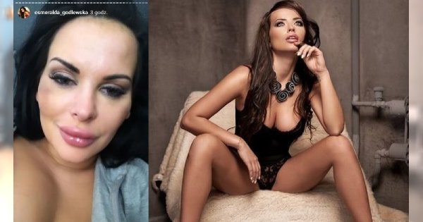 Esmeralda Godlewska za całe zło obwinia swoja siostrę - Magdalenę Godlewską. Pokazuje jej GOŁE PIERSI