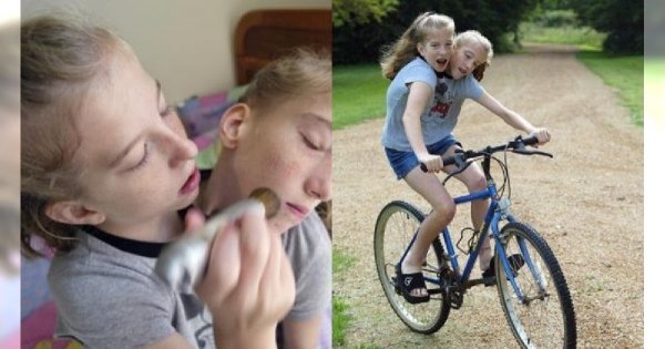 Te siostry mają jedno ciało i dwie głowy! Razem potrafią biegać, jeździć samochodem i na rowerze, a niedawno zostały nauczycielkami!