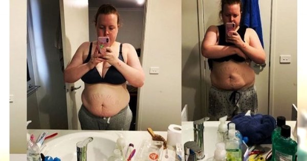 Ta mama pokazała ciało po ciąży i zamieściła odważny wpis: "Dlaczego niby mam kochać swoje ciało?"