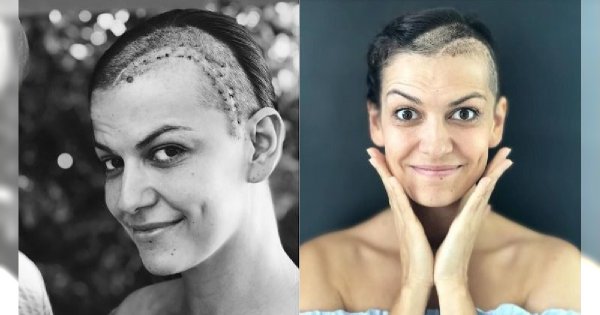 Alżbeta Leńska świętuje swoje "pierwsze urodziny"! Dokładnie rok temu w jej głowie pękł krwiak. Zobaczcie, jak dziś wygląda