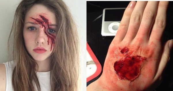 Co się stało córce Ewy Gawryluk? Wygląda jak z horroru. Galeria dla osób o mocnych nerwach!