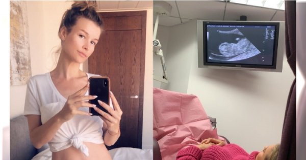 Joanna Krupa pokazała ciążowy brzuch. Fanki w szoku, że jest już taki duży!
