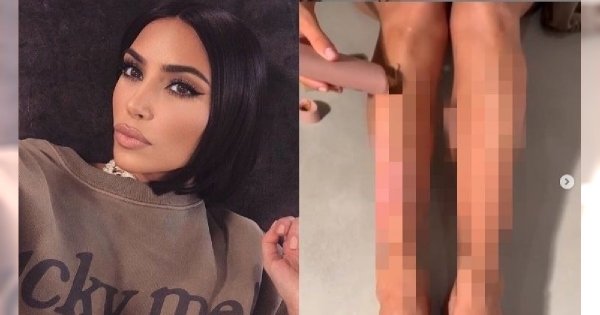 Tak naprawdę wyglądają nogi Kim Kardashian. Gwiazda pokazała, co przez chorobę codziennie zakrywa warstwą podkładu