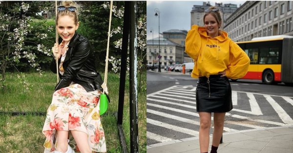 Co się stało Oldze Kalickiej? Fani zastanawiają się, czy ktoś ją uderzył. Jaka jest prawda? Zobaczcie zdjęcia