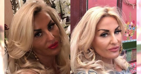 Dagmara Kaźmierska pokazała zdjęcie ze szpitala po wypadku! Widać sporą ranę na twarzy