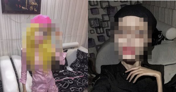 Ta dziewczyna ma 21 lat i ponad 50 operacji plastycznych za sobą. Chciała wyglądać jak Angelina Jolie, stała się potworem
