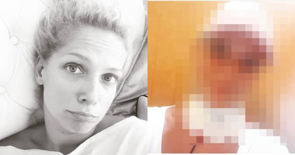 Joanna Liszowska nie może mówić? Pokazała zdjęcie z bandażem na szyi. Co się stało?