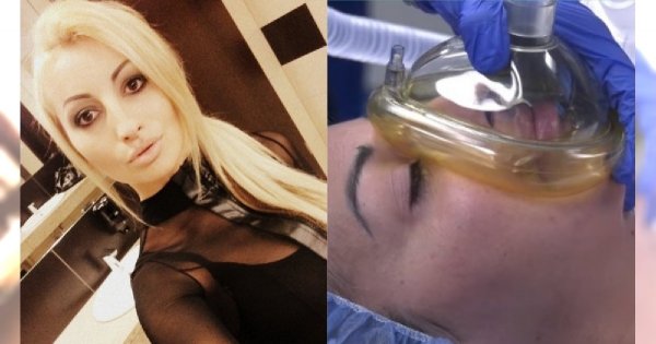 Jola Rutowicz zrobiła operację plastyczną nosa przed kamerami. Zdjęcia mrożą krew w żyłach!