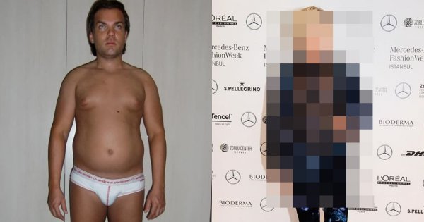 Przeszedł prawie 200 zabiegów by wyglądać jak żywy Ken. Jaki efekt uzyskał? Zobaczcie sami!