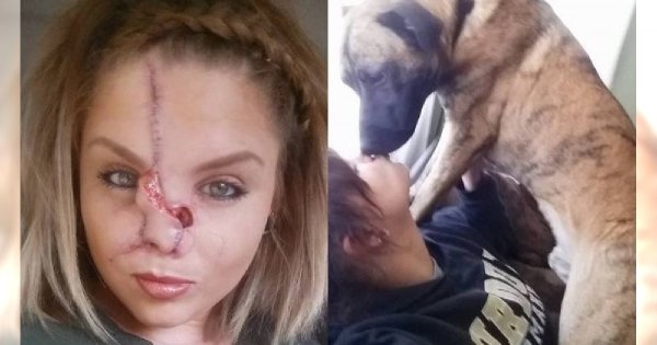 Pies odgryzł jej nos i pozbawił zębów, lecz ona dalej pozwala sobie na poufałości z czworonogami!