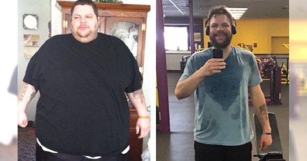 Jak wygląda skóra po zrzuceniu 200 kg? Uwaga! Zdjęcia są naprawdę drastyczne!